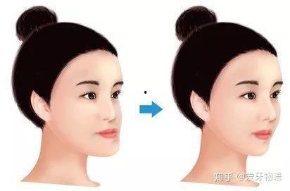 成人翘舌音矫正视频,轻松掌握成人翘舌音矫正技巧